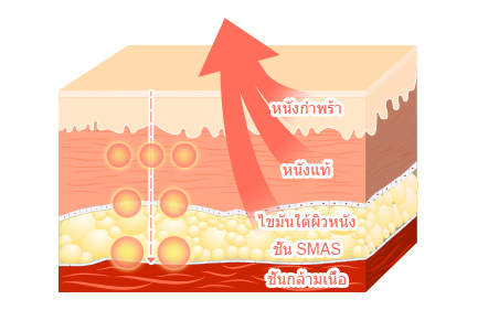 피부층